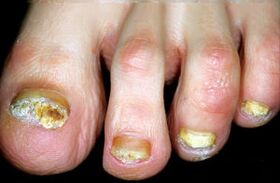 Caracterización da enfermidade