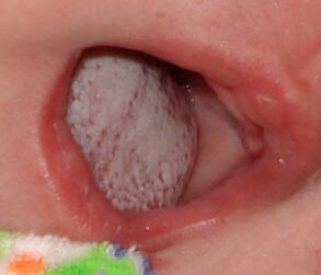 Localización da enfermidade cun fungo