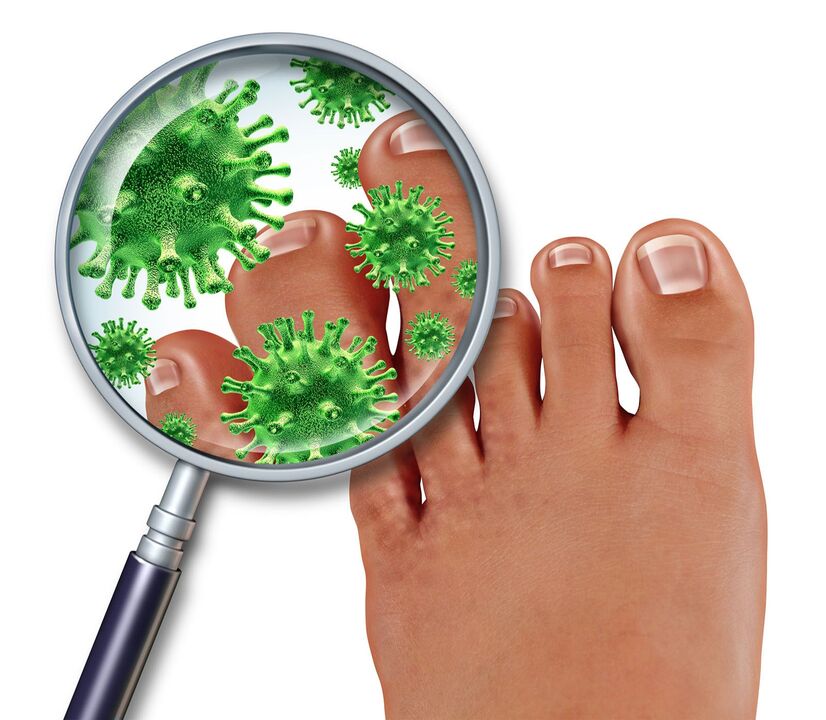 fungo das unhas dos pés